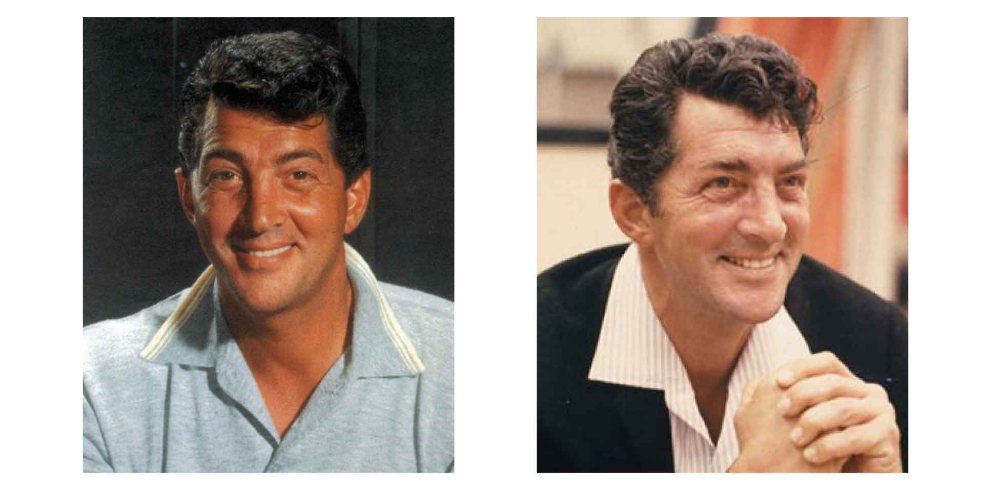 Dean Martin's hairpiece